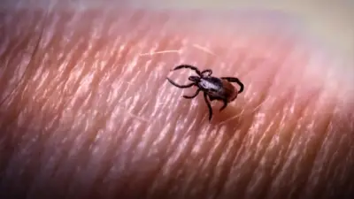 How to protect yourself from ticks year-round