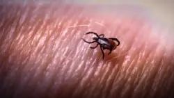 How to protect yourself from ticks year-round